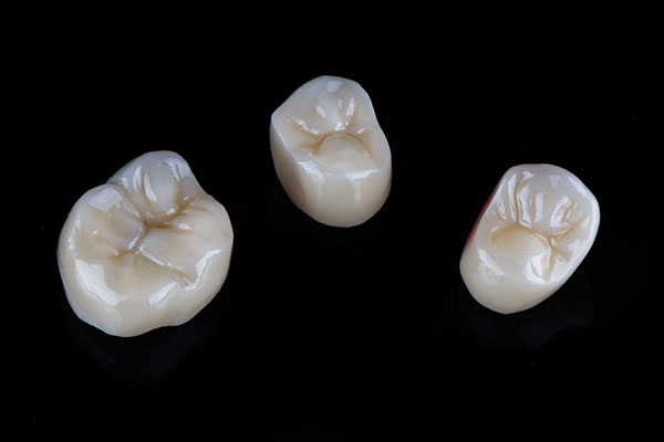 A Comparison of Dental Crown Materials from Gregory Zabek Advanced General & Cosmetic Dentistry in San Francisco, CA