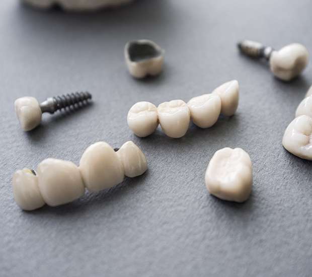 San Francisco The Difference Between Dental Implants and Mini Dental Implants