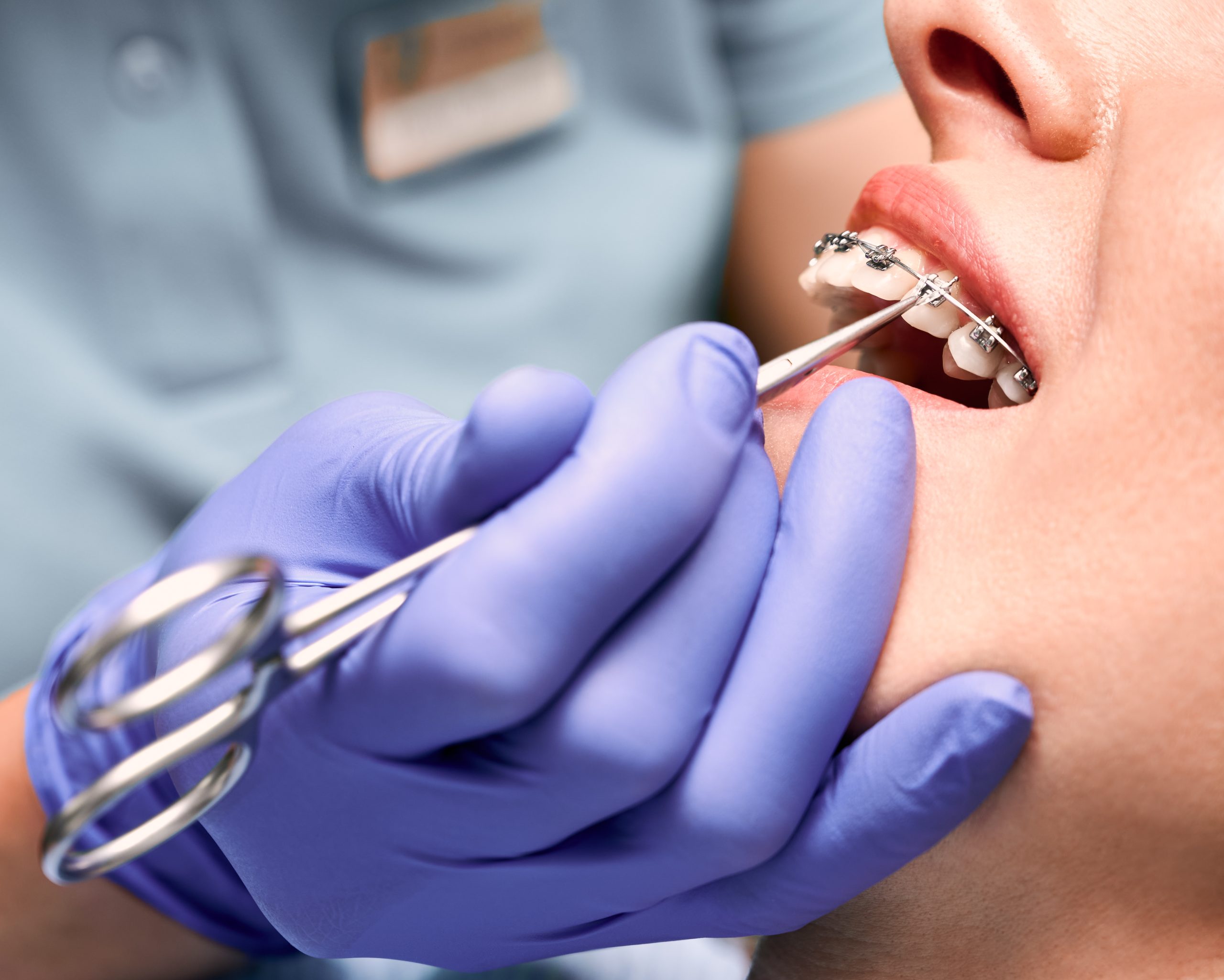 Your Guide To Getting Braces As An Adult — It’s Never Too Late!