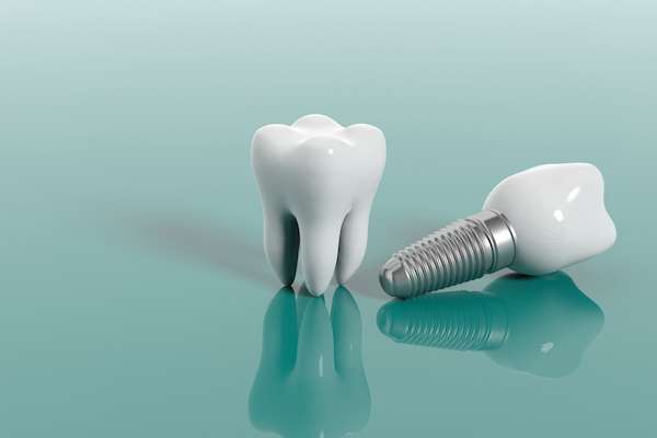 Questions to Ask Your Implant Dentist from Gregory Zabek Advanced General & Cosmetic Dentistry in San Francisco, CA