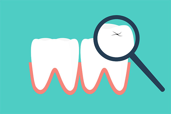 Four Tips for Making Your Dental Crowns Last from Gregory Zabek Advanced General & Cosmetic Dentistry in San Francisco, CA